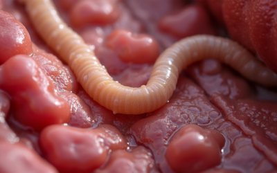 Wriggly Invaders: How Parasitic Worms Affect Human Health